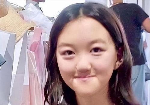 李嫣兔唇照片,勇敢面对，展现自信风采